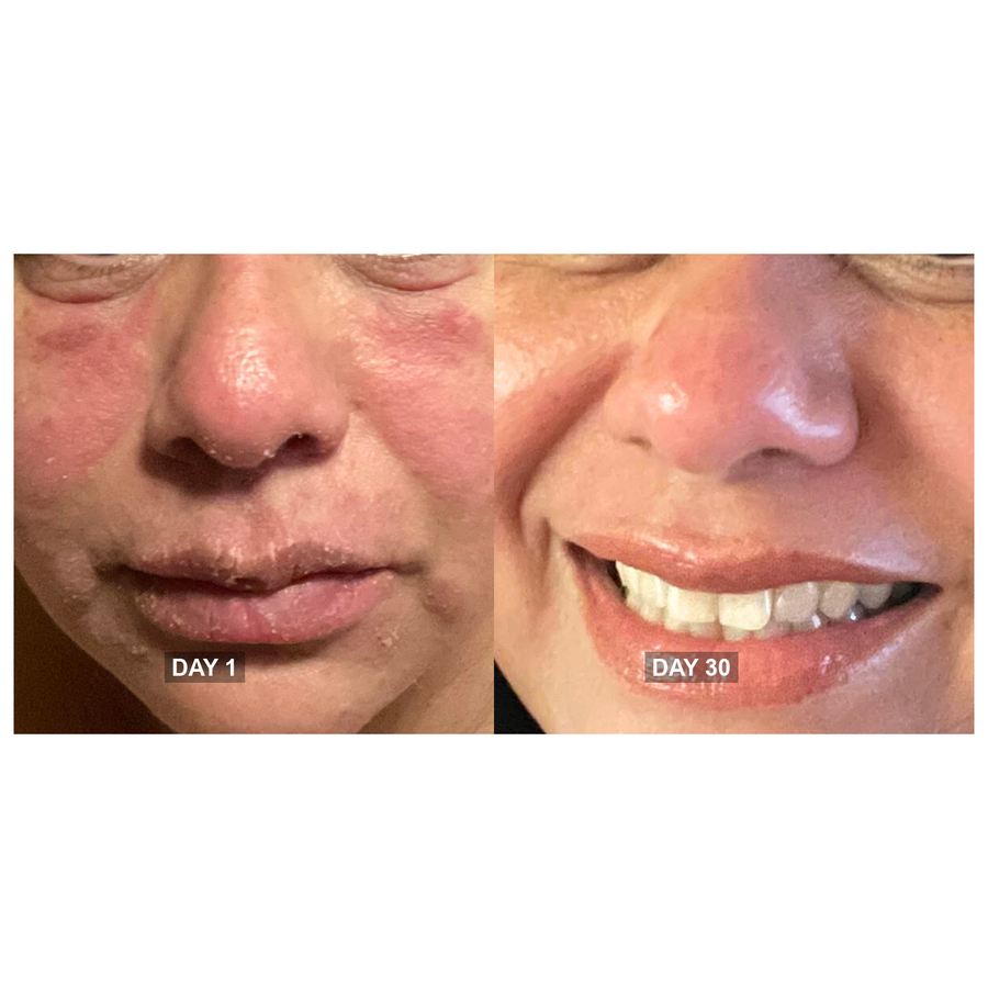 Day 1 and Day 30