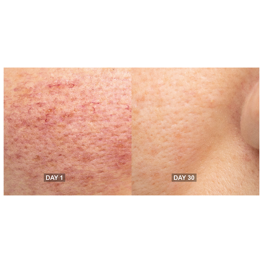 Day 1 and Day 30, close up